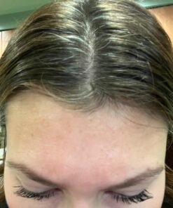 Frownies Forehead and Between Eyes Wrinkle Patches The Original Wrinkle Patch Non Invasive Wrinkle Smoothers for Forehead Wrinkles 41 71PU2Hu3T5L