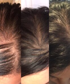 artnaturals Argan Hair Growth Shampoo - (16 Fl Oz / 473ml) - Sulfate Free - Treatment for Hair Loss, Thinning & Regrowth - Men & Women - Infused with Biotin, Argan Oil, Keratin, Caffeine 47 71PbDGNr8xL