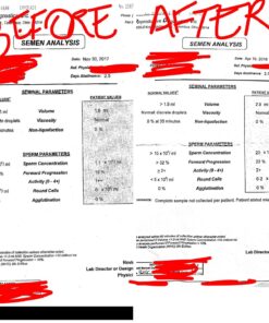 CountBoost for Men - Male Fertility Supplement to Support Count - with Ashwagandha, Maca, Glutathione, B Vitamins - FertilAid for Men Companion Product (60 Capsules / 1 Month Supply) 23 71PpqsAKtvL