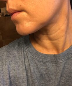 Art Harding's Instant Face & Neck Lift (Dark) - Chemical-Free, Hypoallergenic, for All Skin Types Dark 21 71QNvMynrdL