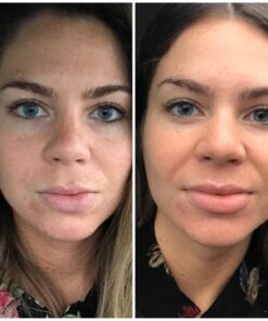 Face Wash, Facial Cleanser, Oil Cleanser - Helps as a Blackhead Remover with Organic Rosemary Oil, Shea Butter and Aloe Vera - Gentle Facewash To Soften, Soothe & Balance Skin, Made in USA, 4oz 37 71QVtxX50JL