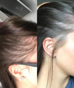 Newopure: Natural Hair Growth Vitamins, Repairs Hair Follicles, Stops Hair Loss, Blocks DHT, Stimulates New Hair Growth, Promotes Thicker, Fuller and Faster Growing Hair. Men & Women (30 Day Supply) 26 71QijhlDdEL