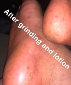 Amope Pedi Perfect Electronic Foot File, Dual-Speed Callus Remover (with Diamond Crystals) for Feet (Extra Coarse - Pink Gadget). -Perfect for In-home Pedicure for Baby Smooth Feet. Battery Operated 35 71RfDkP0FLL