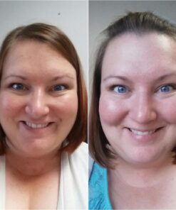 Radha Beauty Moisturizing Miracle Retinol Cream for Face - with 2.5% Retinol, Hyaluronic Acid, Vitamin E and Green Tea. Luxury Night and Day Anti-Aging Wrinkle Cream 1.7 fl oz. 35 71RqFEzNzVL