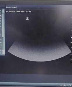 Keebdray DP20Vet Veterinary Small Animal Ultrasound with Micro Convex Probe 13 71RtkCRjg L