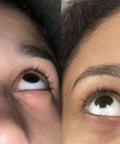 DERMORA Golden Glow Under Eye Patches (20 Pairs Eye Gels) - Rejuvenating Treatment for Dark Circles, Puffy Eyes, Refreshing, Revitalizing, Travel, Wrinkles 20 Count (Pack of 1) 37 71SMjvH 1LL