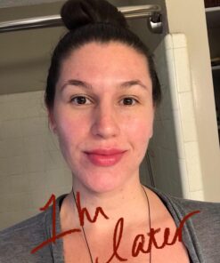 Fullips Lip Plumper Tool - Medium Oval with Bonus Large Round Enlarger - Self Suction Plumping Device For Fuller Lips - Plump in Seconds - Natural Instant Lip Enhancement Kit - Red Plastic Plumpers 52 71SVMzUzwEL