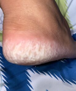 O'Keeffe's for Healthy Feet Foot Cream, Guaranteed Relief for Extremely Dry, Cracked Feet, Instantly Boosts Moisture Levels, 3.2 Ounce Jar, (Pack of 1) 3.2 Ounce (Pack of 1) 40 71SXTXtIFuL