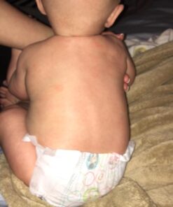 Cetaphil Pro Restoraderm Gentle Body Moisturizer, Eczema Calming, 10-Fluid Ounces 10 Ounce (Pack of 1) 25 71SqqedRsfL