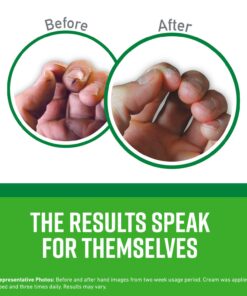 O'Keeffe's K0350002-4 Working Hands Hand Cream in Jar (4 Pack), 3.2 oz 3.2 Ounce (Pack of 4) 7 71SsRTDTzvL