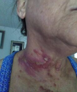 Tea Tree Oil Balm , Extra Strength, Pair Well with Jock Itch Cream, Spray, Athletes Foot, Ringworm Cream for Human, Fast Acting for Dry, Itchy Skin, Plant Powered Wonder Balm 32 71TUf4PsrDL