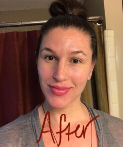 Fullips Lip Plumper Tool - Medium Oval with Bonus Large Round Enlarger - Self Suction Plumping Device For Fuller Lips - Plump in Seconds - Natural Instant Lip Enhancement Kit - Red Plastic Plumpers 53 71TXtz7i9vL