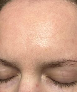 Frownies Forehead and Between Eyes Wrinkle Patches The Original Wrinkle Patch Non Invasive Wrinkle Smoothers for Forehead Wrinkles 33 71U1xbkhd0L