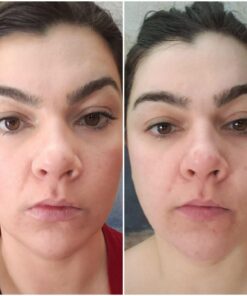 Fullips Lip Plumper Tool - Medium Oval with Bonus Large Round Enlarger - Self Suction Plumping Device For Fuller Lips - Plump in Seconds - Natural Instant Lip Enhancement Kit - Red Plastic Plumpers 62 71U2cS02dcL