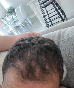 iRestore Essential Laser Hair Growth System - FDA Cleared Hair Loss Treatments for Men & Women & Hair Growth Products for Men with Thinning Hair, Hair Regrowth Treatments Laser Cap, Red Light Therapy 51 71U3P1uYCeL