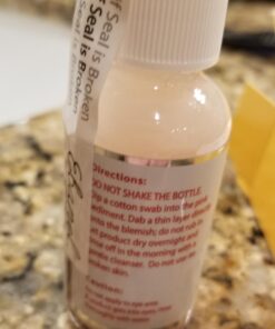 Ebanel Acne Drying Lotion, Overnight Salicylic Acid and Sulfur Cystic Acne Spot Treatment for Face and Body, Pimple Cream Spot Treatment, Dries Out Pimples, Cysts, Blemishes, Zits, and Clogged Pores 38 71UDOPwa1sL