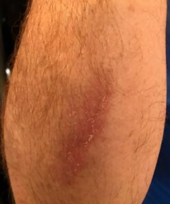 BerbereX Antimicrobial Wound Cleanser for Cuts, Scrapes, Burns, Incisions, Piercing Aftercare, Wounds, Wound Care, First Aid Antiseptic Antibacterial Spray, Pressure Sore, Diabetic Ulcer - 4oz 14 71UcGWmlB L