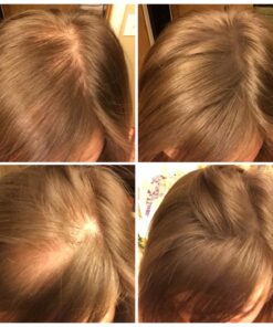 XFusion Keratin Hair Fibers - Black (Large Size 28g) Medium Brown 32 71Uegw9NyPL