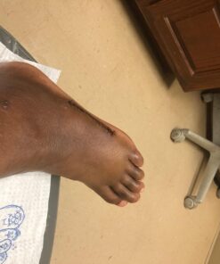 Mepitac 298400 Soft Silicone Tape, 1-1/2" x 59" 10 71UonKclg L