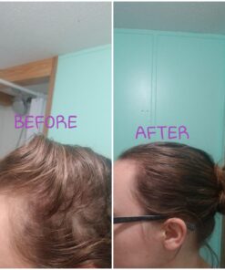 XFusion Keratin Hair Fibers - Black (Large Size 28g) Medium Brown 37 71V HvM81NL