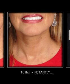 NeckTITE Magic - The Instant Neck Lift 12 Count (Pack of 1) 16 71VLfgY1aOL