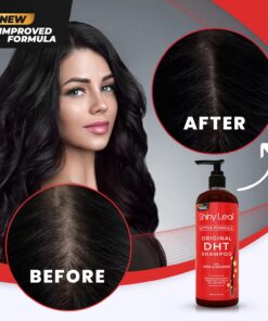 DHT Blocker Anti-Hair Loss Shampoo With Biotin, for Men & Women, Sulfate Free, Natural DHT Blocking Shampoo for Hair Growth, For Thinning Hair, Hair Fall and Hair Loss Prevention, Active Formula (16 Oz) 16 Fl Oz (Pack of 1) 17 71VX5eFzfL