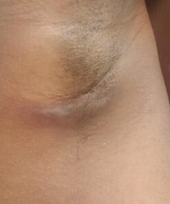 Smile's PRID Drawing Salve by Hyland's, Relief of Topical Pain and Skin Irritations, 18 grams 28 71VtU22oADL