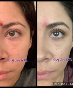 Moisturising Cream, Body and Face Moisturizer for Dry Skin, Acne Cream, 2PC 0.53 Ounce (Pack of 1) 44 71W17iHOK5L