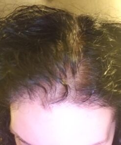 vitafusion Extra Strength Biotin Gummy Vitamins, Berry Flavored, 5,000 mcg Biotin Vitamins, America’s Number 1 Gummy Vitamin Brand, 50 Day Supply, 100 Count (Packaging may vary) 65 71WLWqHoD0L