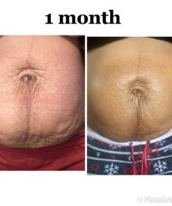 Nivea Skin Firming and Toning Body Gel Cream with Q10, Firming Body Cream, Moisturizing Skin Cream, 6.7 Oz Tube Skin Firming Gel 51 71WbScQNTvL