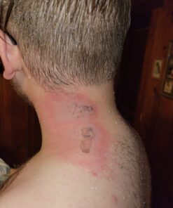 SilverSeal Burn and Wound Dressing | Hydrogel Pads with X-Static Silver | Soothing, Moist & Protective | Burns, Cuts & Wounds | 4 Sterile Dressings 4"x4" Patch (4 Count) 58 71Wf4JOmWjL