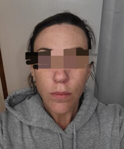 Facial Smoothies VARIETY Wrinkle Remover Strips, 160 anti wrinkle patches in 6 shapes 37 71Wlt8ugXUL