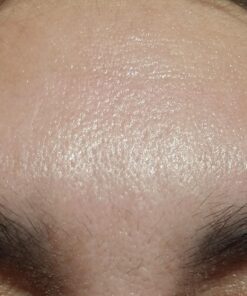 Facial Smoothies VARIETY Wrinkle Remover Strips, 160 anti wrinkle patches in 6 shapes 41 71Wyr9m1LlL