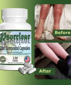 Psorclear-Psoriasis & Eczema Relief | A Proven Effective and All-Natural Product for Psoriasis Eczema & Rosacea Relief That Works - Rated One of The Best (120 Count Bottle) 15 71WzRr7h7mL