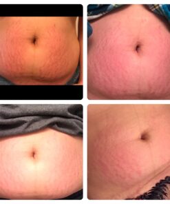 Brooklyn Botany Dead Sea Salt and Arabica Coffee Body Scrub 10 oz - Moisturizing and Exfoliating Body, Face, Hand, Foot Scrub - Fights Stretch Marks, Fine Lines, Wrinkles - Great Gifts for Women & Men 10 Ounce (Pack of 1) 30 71X27EyjLL