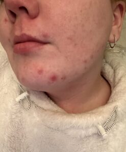 Terrasil Wound Care - 3X Faster Healing, Infection Protection Ointment for bed sores, pressure sores, diabetic wounds, ulcers, cuts, scrapes, and burns (14 gram tube) 46 71XNoikYjQL