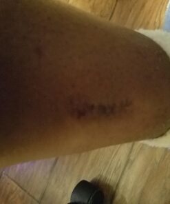 BerbereX Antimicrobial Wound Cleanser for Cuts, Scrapes, Burns, Incisions, Piercing Aftercare, Wounds, Wound Care, First Aid Antiseptic Antibacterial Spray, Pressure Sore, Diabetic Ulcer - 4oz 12 71XlzMxywiL