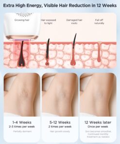 INNZA Laser Hair Removal with Ice Cooling Care Function for Women Permanent,999,999 Flashes Painless IPL Hair Remover, Hair Removal Device for Armpits Legs Arms Bikini Line (1-White) 1-white 21 71XwZYmQmvL