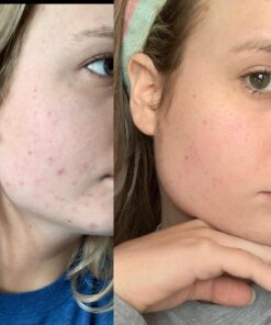 NOW Foods Supplements,Pantothenic Acid (Vitamin B-5) 500 mg,B-Complex Vitamin,250 Capsules 250 Count (Pack of 1) 37 71YJ3jQlxSL