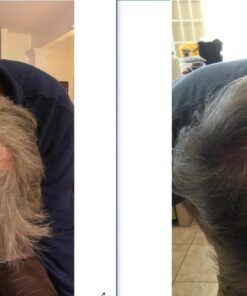 Growth Treatment Unscented 5% (Foam) 2 Ounce (Pack of 1) 15 71YVdWgoBmL