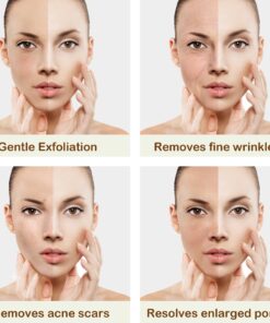 Kendal 3 in 1 Professional Diamond Microdermabrasion Machine 16 71YZikFTa6L