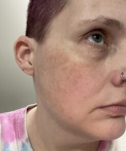 TruSkin Vitamin C Face Serum – Anti Aging Face & Eye Serum with Vitamin C, Hyaluronic Acid, Vitamin E – Brightening Serum, Dark Spot Remover, Even Skin Tone, Eye Area, Fine Lines & Wrinkles, 1 Fl Oz 1 Fl Oz (Pack of 1) 45 71YsC6AAzWL