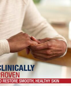 Aquaphor Healing Ointment, Advanced Therapy Healing Ointment for Dry Skin, Skin Protectant for Dry Cracked Skin - 1.75 oz. Tube (Pack of 6) 1.75 Ounce (Pack of 6) 18 71YvOxJeW7L