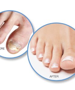 Barielle Fungus Rx 1 ounce 11 71YyhA6ljNL