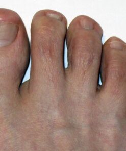 ZenToes Gel Toe Separators for Overlapping Toes, Bunions, Big Toe Alignment, Corrector and Spacer - 4 Pack (Beige) Beige 33 71ZD8AfN88L