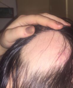 Nourish Beaute Hair Regrowth Treatment Serum for Hair Loss, Volume and Thickening with Caffeine for Men and Women, 1.7 Oz 26 71ZbXpHsGbL