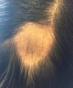 Naturenetics HairAnew Hair Growth Vitamins for Women & Men - Hair Vitamins For Faster Hair Growth & Thickness - Part of Proceeds go to Hair Loss Charity - Vegan Hair Supplement For Hair Skin Nails (1) 1 35 71ZyV7PntiL