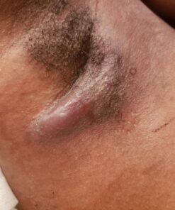 Smile's PRID Drawing Salve by Hyland's, Relief of Topical Pain and Skin Irritations, 18 grams 29 71aCumX7SSL