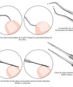 ZIZZON 7 Pcs Ingrown Toenail File and Lifters Set, Stainless Steel Ingrown Toenail Removal Kit, Manicure Treatment Under Nail Cleaner Pedicure Tools 7pcs 24 71aU8hCJaPL