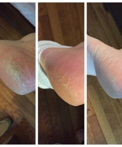 O'Keeffe's for Healthy Feet Foot Cream, Guaranteed Relief for Extremely Dry, Cracked Feet, Instantly Boosts Moisture Levels, 3.2 Ounce Jar, (Pack of 1) 3.2 Ounce (Pack of 1) 32 71akcAHgcGL